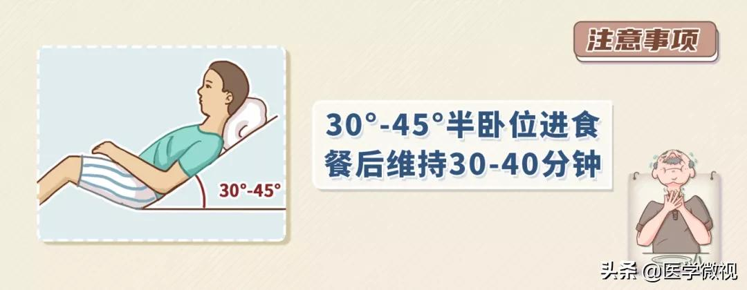 吃饭容易呛?喝水总是咳?警惕这种“隐形杀手”
