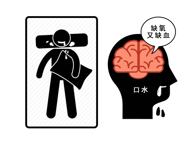 血栓“藏”在体内，并非毫无征兆，这6个细微之处，需注意观察