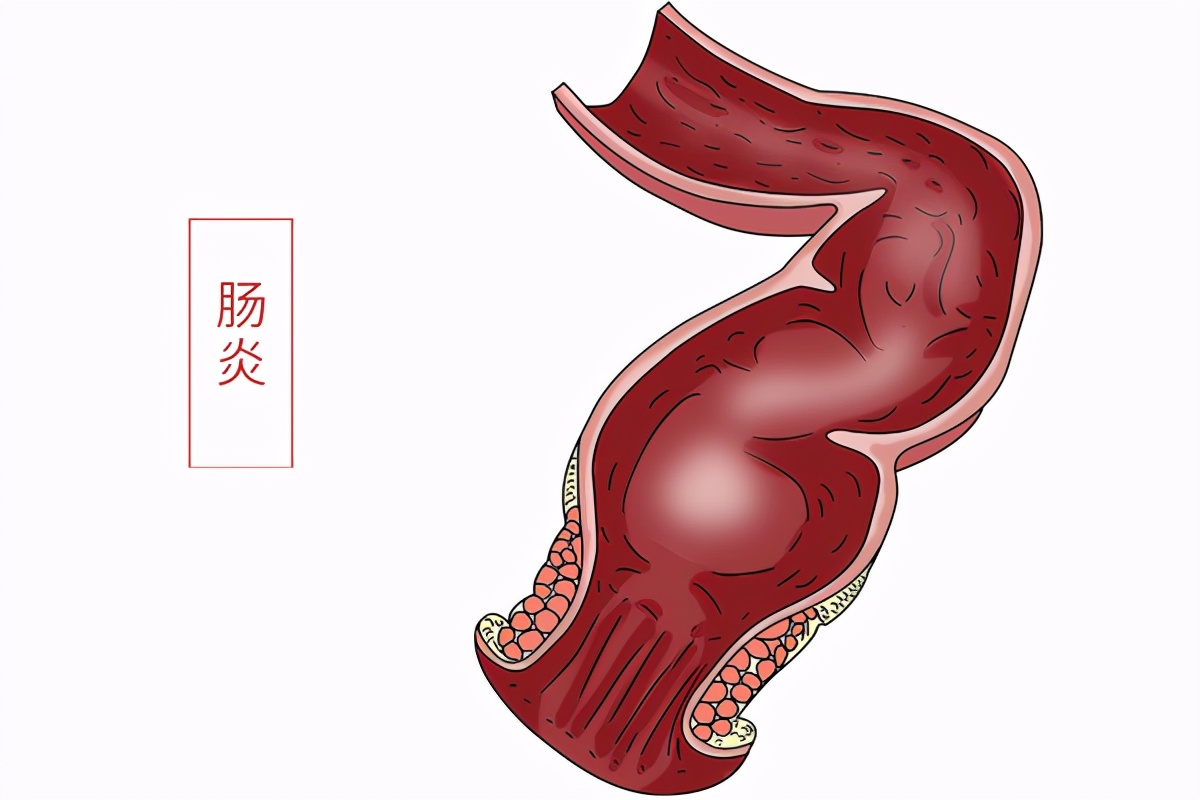 肚子总是鼓鼓的，还经常咕咕叫，是什么原因？应如何调理？