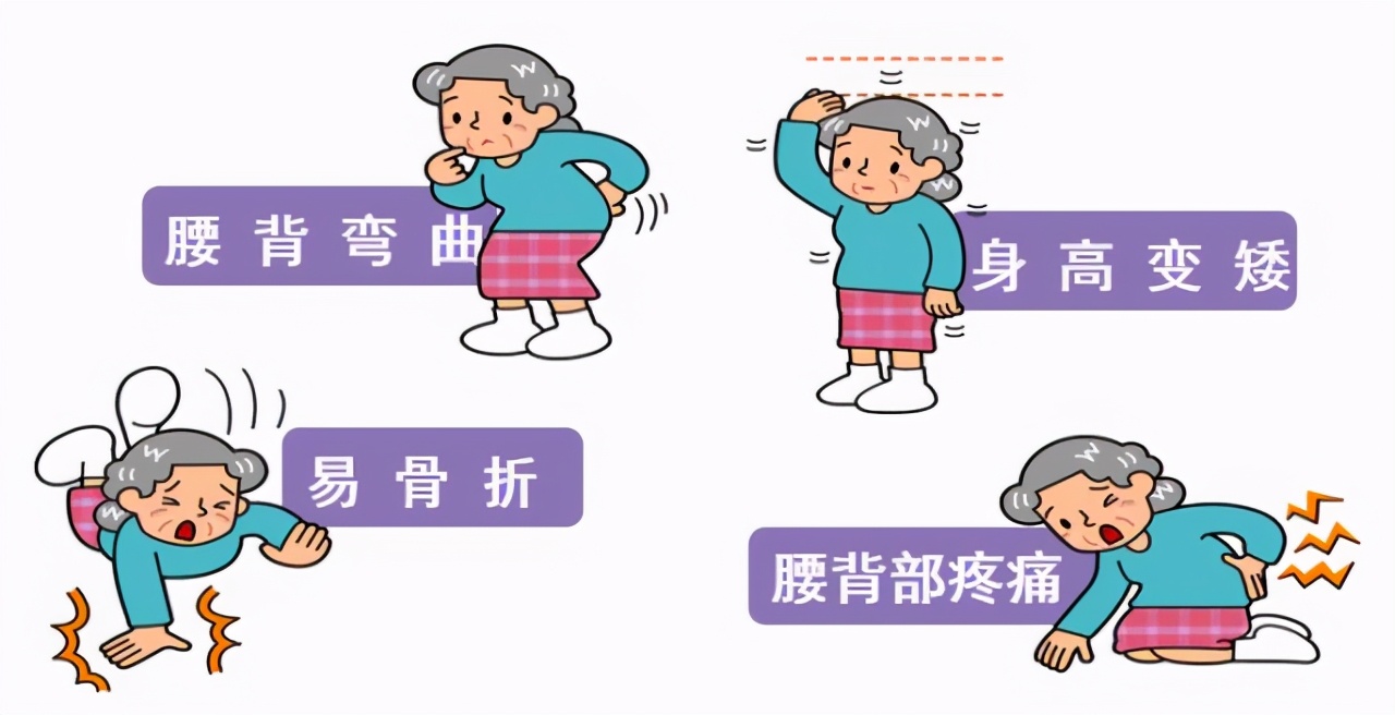人人都避不开骨骼变老!退行性骨关节炎与骨质疏松理应早预防
