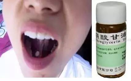 “救命药”硝酸甘油怎么用？这样用才救命，用错了可能要命