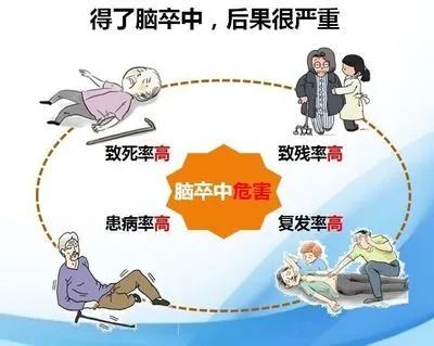 头部血管堵塞越严重,脑卒中的发病率高!有这些症状别大意