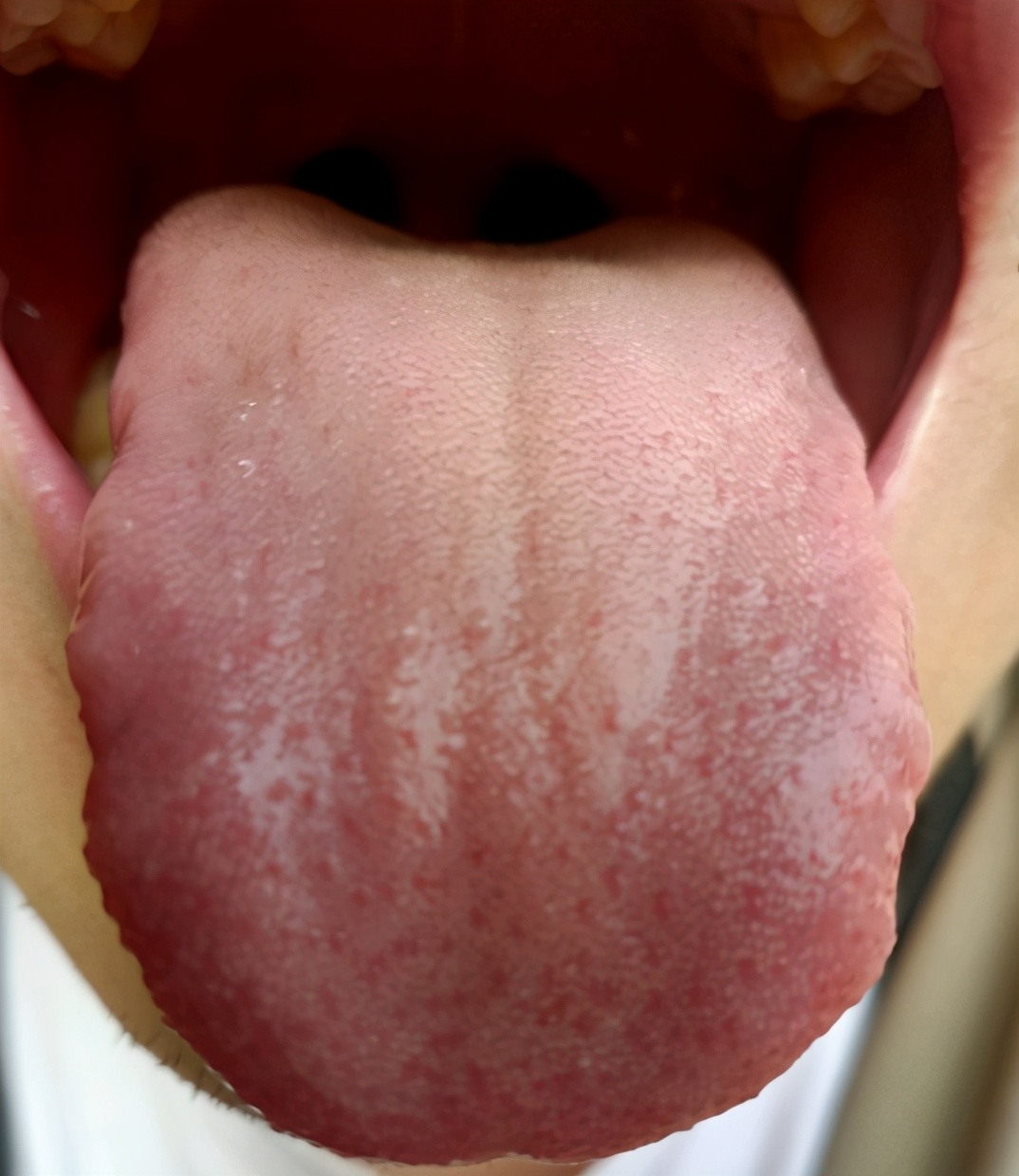 经常头晕、头脑昏沉?问题在脾,4个健脾祛湿方,帮你一招搞定