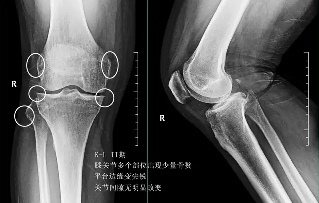 每天走一万步，对身体是好是坏？如果您也有此疑惑，请看此文