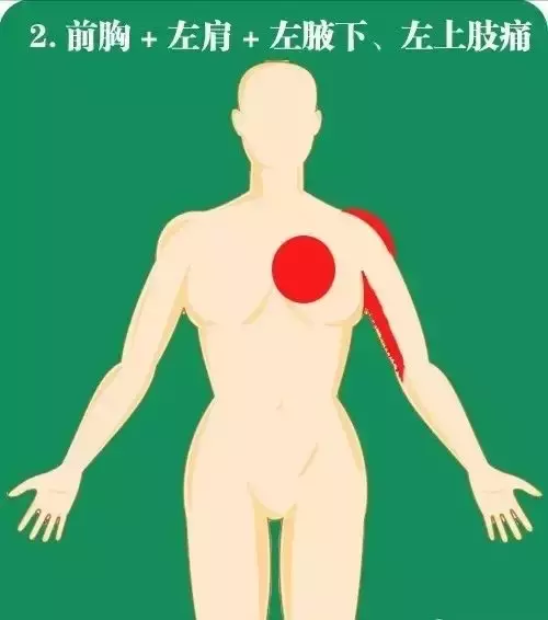 记住，急性心梗，身体这10个部位会报警！