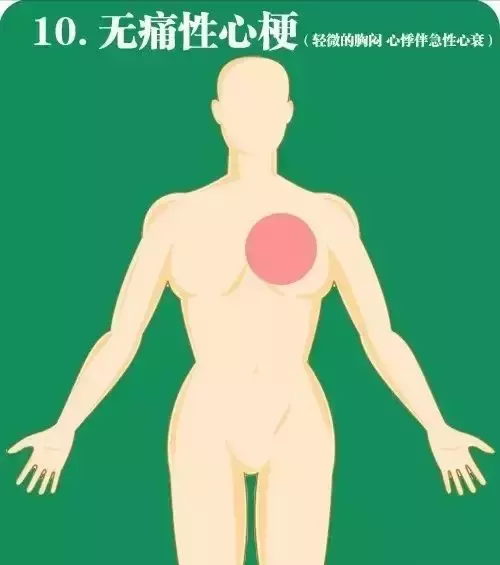 记住，急性心梗，身体这10个部位会报警！