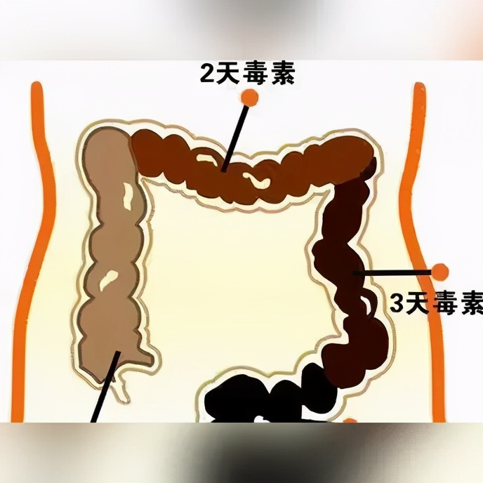 什么是便秘？便秘有什么危害，便秘和口臭有关系么？
