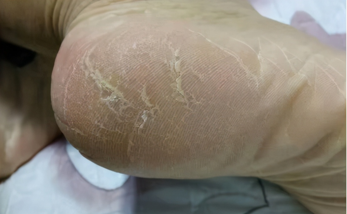 一个人的肝好不好，身体这4个部位一眼“看穿”，怎么藏也藏不住