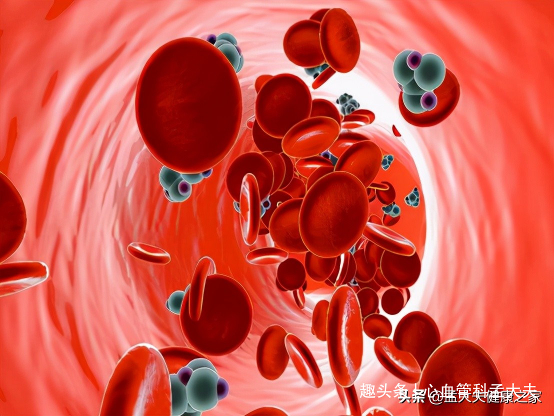 降脂必看，得了高血脂症和动脉粥样硬化，该怎么办？