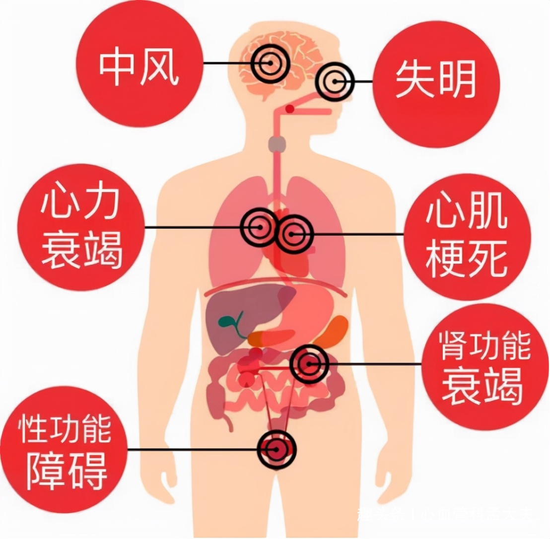 高血压患者不能只知道吃药降压，5大非药物降压方法也很有效